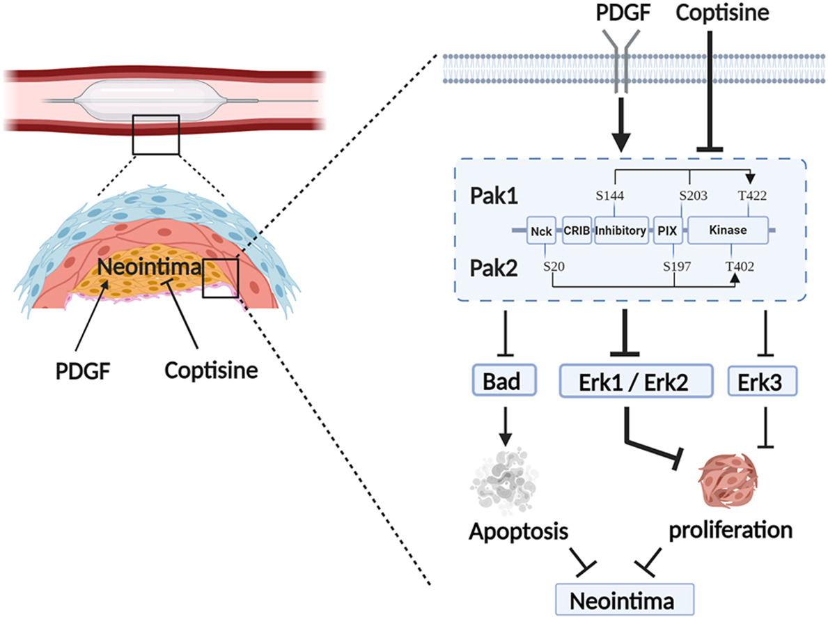 The phosphor-sites of Pak1 (S144/S203) / Pak2 (S20/S197) constitute a potential drug-screening target for fighting neointimal hyperplasia restenosis 🫀 🔗atherosclerosis-journal.com/article/S0021-… @society_eas #CvPrev @ELS_Cardiology