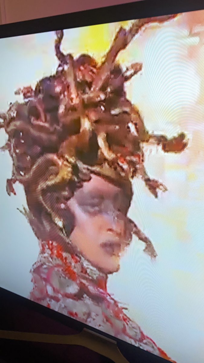 _pablomerchan's tweet photo. @atresplayer el canal en directo de Drag Race se ve fatal. Muy pixelado. He mandado ya dos incidencias a través de la app y no obtengo respuesta. Me ocurre en la AppleTV y en el iPad. Y no es un problema de conexión. Ayuda please! ☹️💔 https://t.co/5ysfx0y0PS