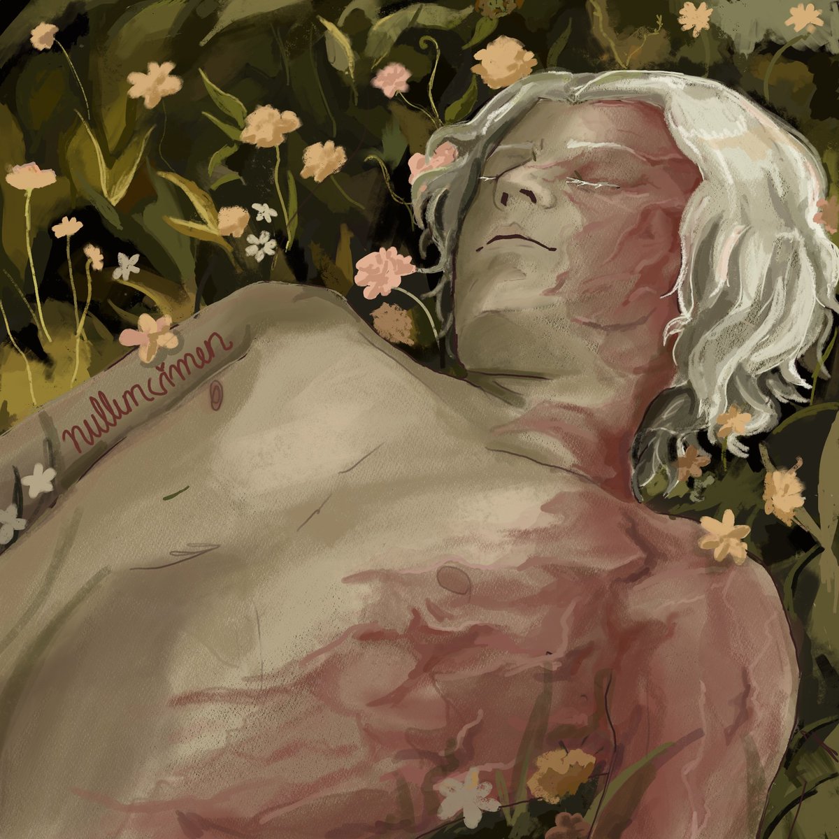 Aegon after being burned by dragonfire. (He is still so beautiful to me) #AegonTargaryen #HouseOfTheDragon