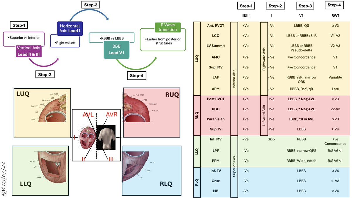 PVC Localization!
Inspired by the 2019 HRS article by Enriquez et al. on the Site of Origin (pubmed.ncbi.nlm.nih.gov/30954600/).

The figure is restructured. 🫀 The primary view is Posterior-Anterior. Take it step by step, and it will make sense.

Systemic Approach:
1-Start with the
