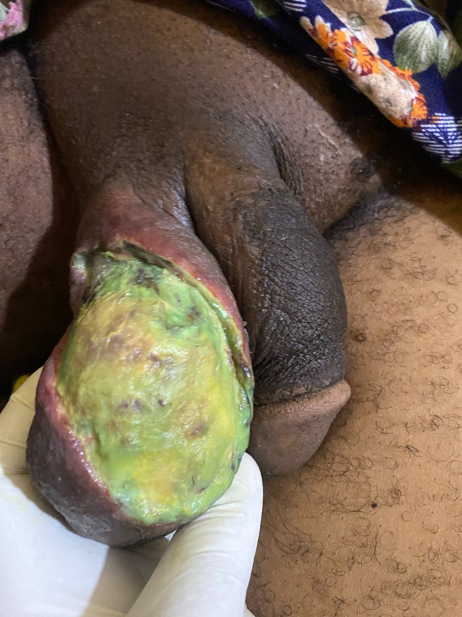 ARD_FMCA_ABEOKUTA tweet media