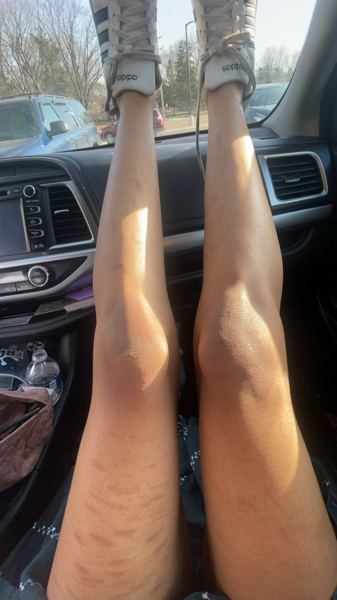 sssSumayaaa's tweet photo. Am I thin enough(I feel so fat no matter what I do and I’d rather die than feel like this again) https://t.co/53Xe94Xhia