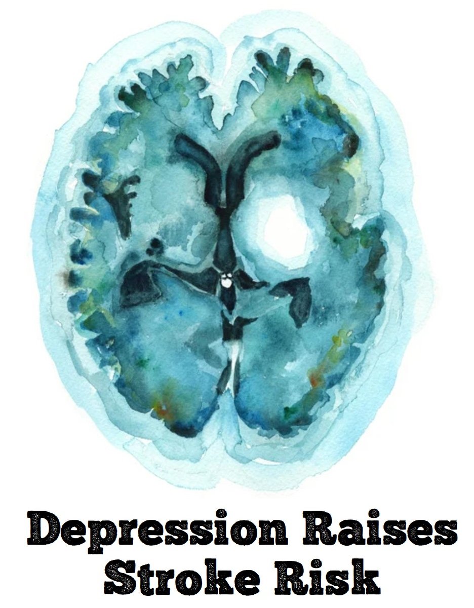 Stroke causes depression, but #depression also raises the risk of #stroke, about 1.5 times, finds this case-control study of 26,877: pubmed.ncbi.nlm.nih.gov/36889922 Interesting, but the association may be due to other risk factors that are shared by both illnesses #neurology