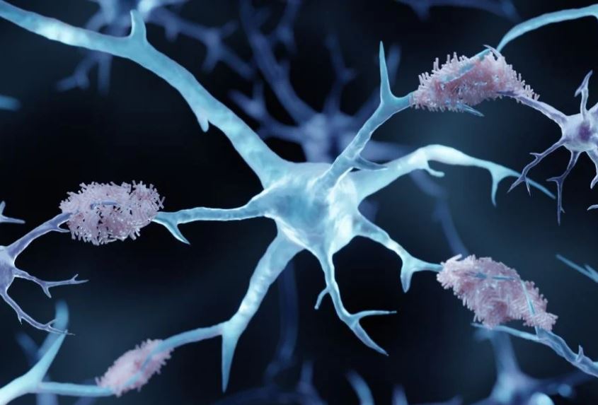 talius's tweet image. #Blocking Key #Potein may #Halt #Progression of #Alzheimer&apos;s disease 

Researchers have found that inhibiting a key protein Mdm2 can stop the destruction of synapses and dendritic spines commonly seen in Alzheimer&apos;s disease.... scitechupdates.com/blocking-key-p…