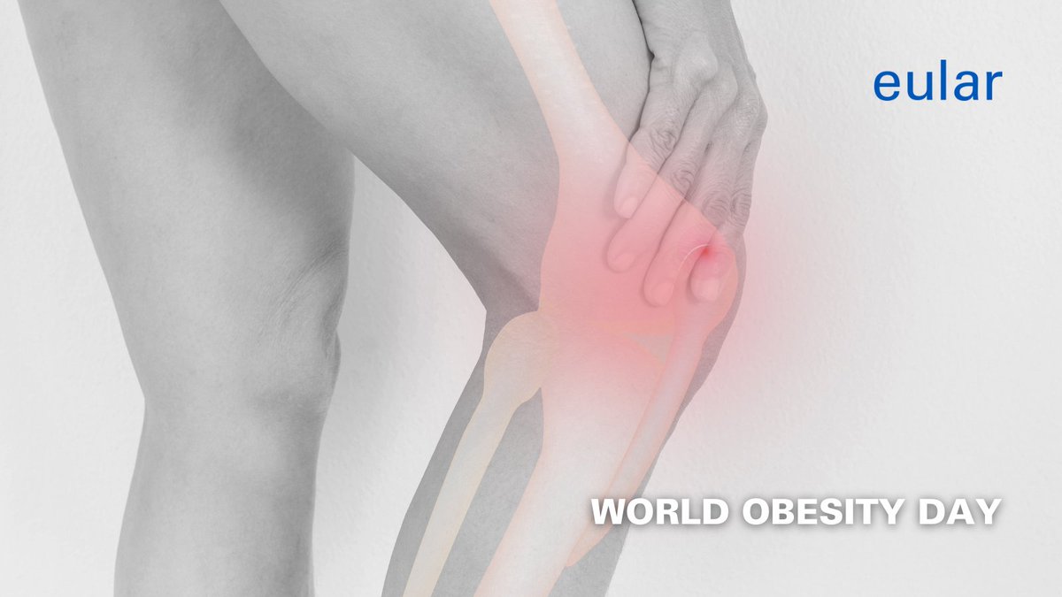 eular_org's tweet photo. 🌏Today is #WorldObesityDay!
🙌Together, let's address obesity by sharing knowledge, advocating collectively, and joining the movement for a healthier world.
#ChangeTogether #WOD2024 https://t.co/v3Njq1OwOr