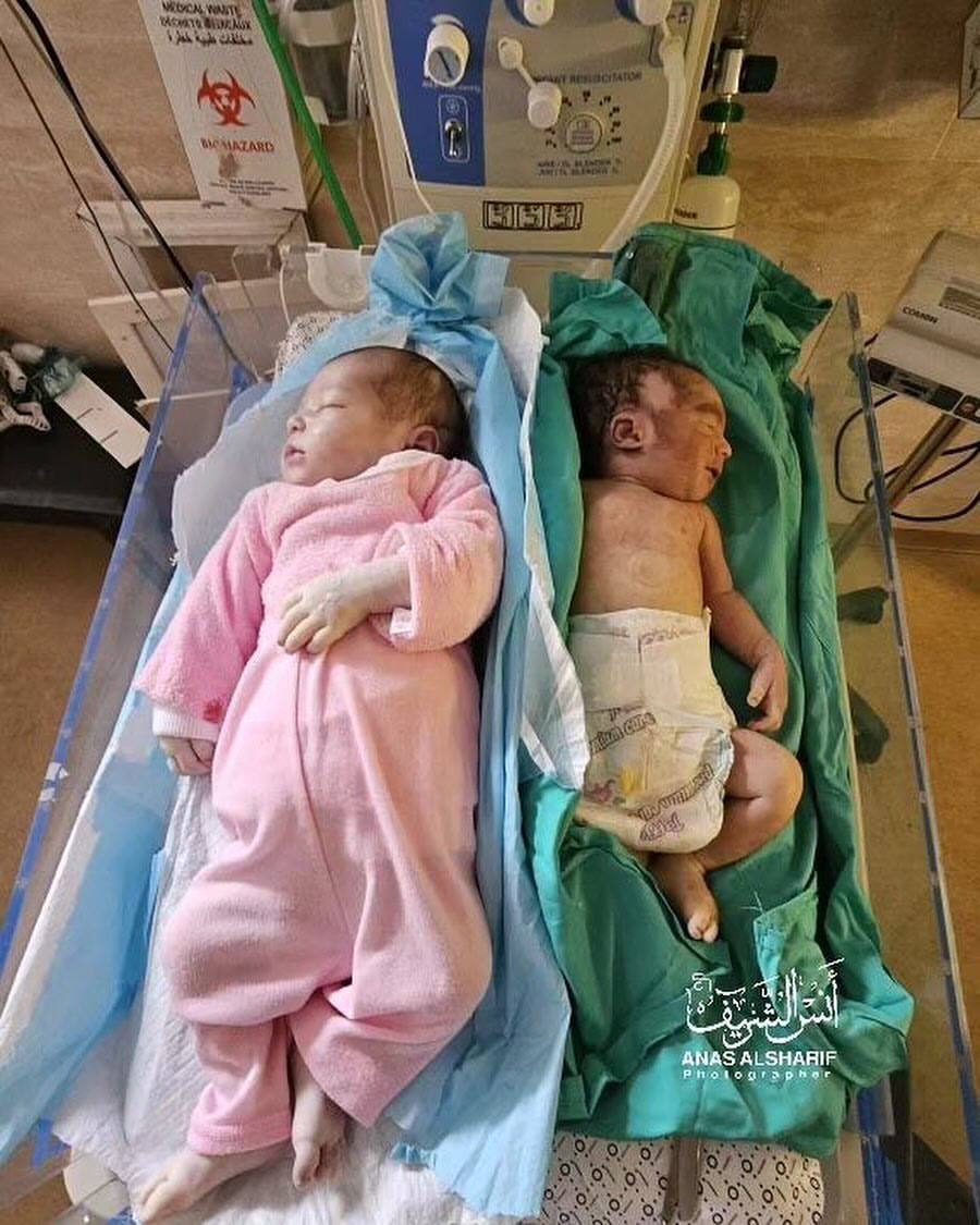 AnggiCartwheel's tweet photo. Sampai hari kemarin, sudah 15 bayi yg meninggal di RS Kamal Odwan di utara Gaza karena kekurangan makanan, susu dan perawatan medis. 💔 https://t.co/tid3H8CdIV