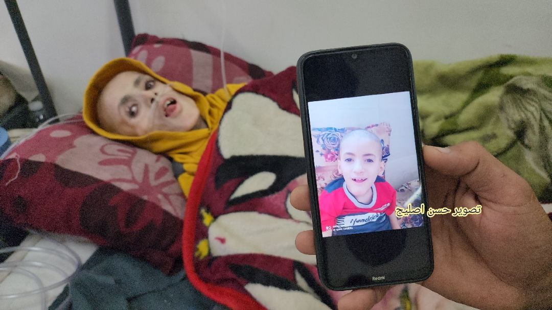The child Yazan Kafarnah dies in Rafah, Gaza from malnutrition due to Israel's ongoing siege, depriving over 2 million people in Gaza of food and water.
