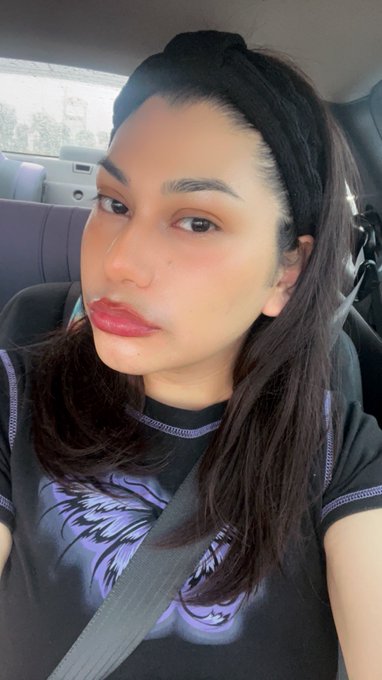 I&rsquo;m in love even doe they are swollen hehe https://t.co/VixNJ12i4P