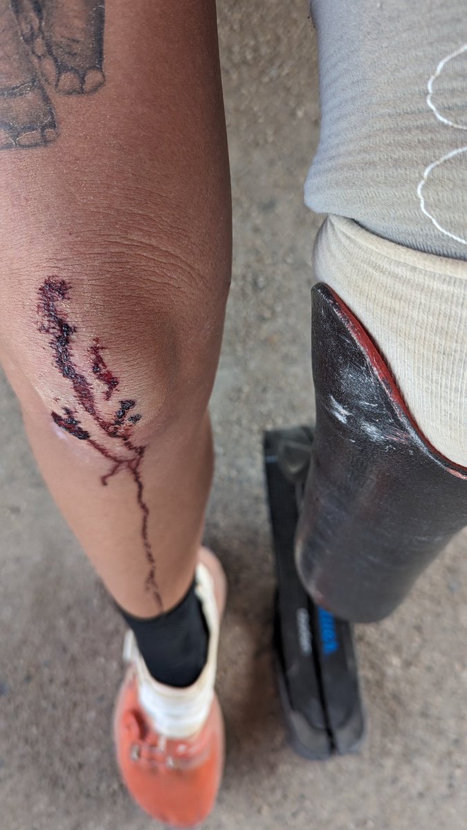 Pin by Gabriel Andrés Lima Peralta on Proyectos que debo intentar | Oliver  sykes tattoos, Oliver, image size:675x1200