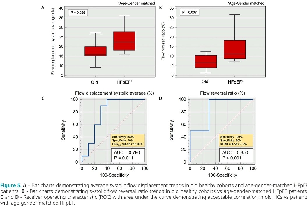 Pankaj Garg (@heartinmagnet) on Twitter photo Aortic Flow is abnormal in HFpEF. Our latest research: doi.org/10.12688/wellc…
👌Congrats to all for helping unravel aortic flow signatures in HFpEF!🎉 🙏
<a href="/pswoboda81/">peter swoboda</a> @AndyJSwift <a href="/Cardiac_MRI/">Cardiac MRI</a> <a href="/whyCMR/">CMR</a> <a href="/BSCMR/">BSCMR</a> <a href="/wellcometrust/">Wellcome</a> <a href="/BSCMR/">BSCMR</a> <a href="/SCMRorg/">Society for Cardiovascular Magnetic Resonance</a> <a href="/cmr_community/">CMR Community</a> <a href="/WHYCMR_BOT/">WHYCMR-BOT</a> <a href="/ziamehmood88/">Zia Mehmood</a> Aortic Flow is abnormal in HFpEF. Our latest research: doi.org/10.12688/wellc…
👌Congrats to all for helping unravel aortic flow signatures in HFpEF!🎉 🙏
<a href="/pswoboda81/">peter swoboda</a> @AndyJSwift <a href="/Cardiac_MRI/">Cardiac MRI</a> <a href="/whyCMR/">CMR</a> <a href="/BSCMR/">BSCMR</a> <a href="/wellcometrust/">Wellcome</a> <a href="/BSCMR/">BSCMR</a> <a href="/SCMRorg/">Society for Cardiovascular Magnetic Resonance</a> <a href="/cmr_community/">CMR Community</a> <a href="/WHYCMR_BOT/">WHYCMR-BOT</a> <a href="/ziamehmood88/">Zia Mehmood</a>