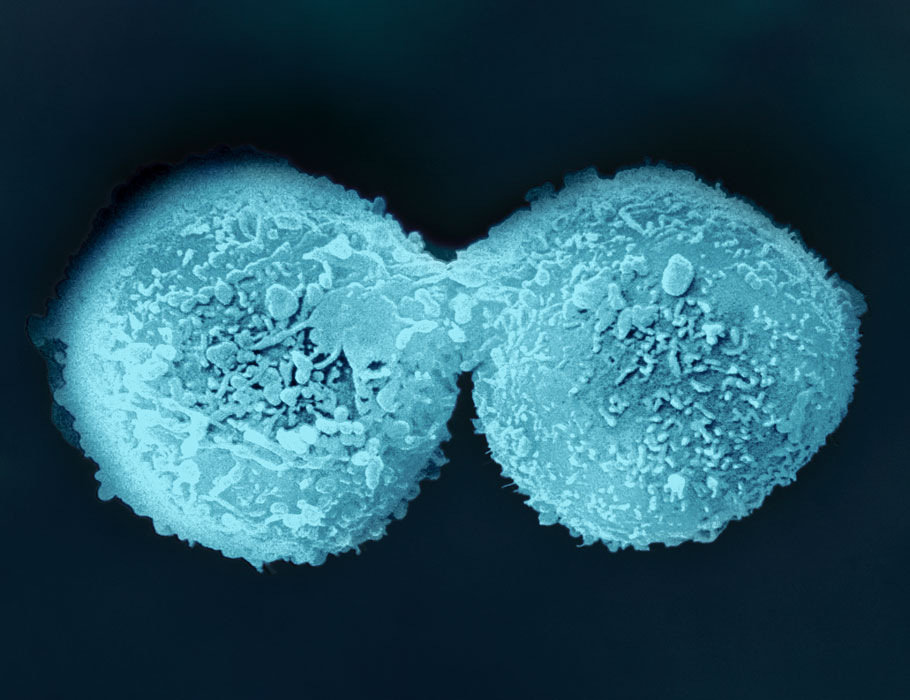 Science Immunology (@sciimmunology) on Twitter photo A new study describes how metabolic changes that take place even before the first cell division is completed can influence clonal lymphocyte expansion. <a href="/metaBailism/">Will Bailis</a>
📄: scim.ag/6gl
Focus: scim.ag/6gm A new study describes how metabolic changes that take place even before the first cell division is completed can influence clonal lymphocyte expansion. <a href="/metaBailism/">Will Bailis</a>
📄: scim.ag/6gl
Focus: scim.ag/6gm