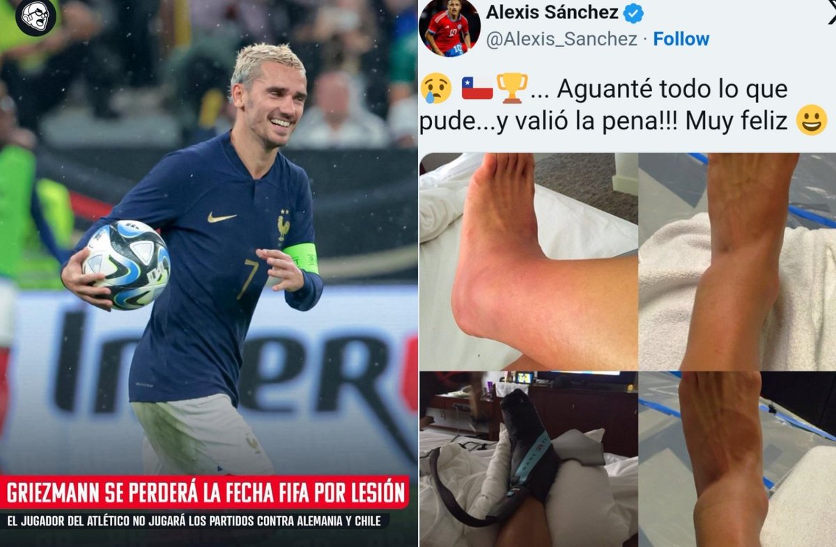 pipef20's tweet photo. Somos reconrosos en chile?? mmm no lo creo.. pero mira @AntoGriezmann
 cagon es no jugar cuando tienes asi un tobillo inflamado por mas de 100 min en cancha o no @Alexis_Sanchez 🤣 https://t.co/rWaC8UZmHF