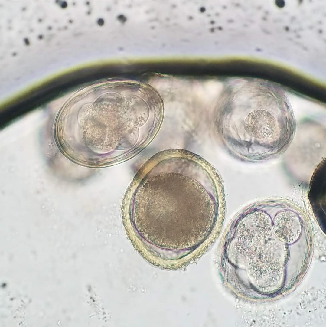 Toxocara canis ovum and 3 Toxascaris leonina ova in a canine fecal sample. Toxascaris can infect canines and felines, with the intermediate host usually being a rodent. This parasite can be found throughout most of the world #parasitology #roundworm #dvm #dogtor #vet #veterinária