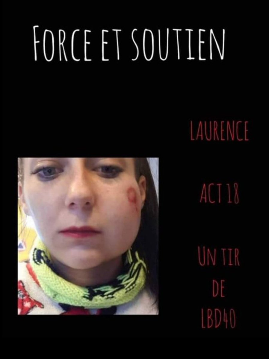 5 ans que laurence a ete touchée par un tire de lbd40 
On oublie pas on pardonne pas