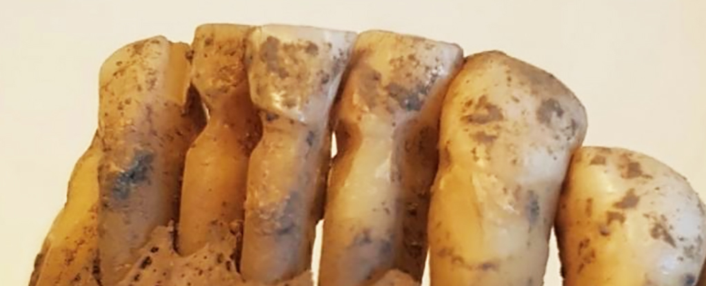 Scientists Studied 3,000 Viking Teeth And Discovered Surprisingly Advanced Dentistry bit.ly/49SEZyI