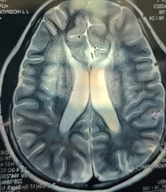 Sucharita (@atirahcus) on Twitter photo Great learning case. A recent ear of the Lynx caught by <a href="/hankshas/">Shashank Nagendra</a> in an advanced case. Great learning case. A recent ear of the Lynx caught by <a href="/hankshas/">Shashank Nagendra</a> in an advanced case.