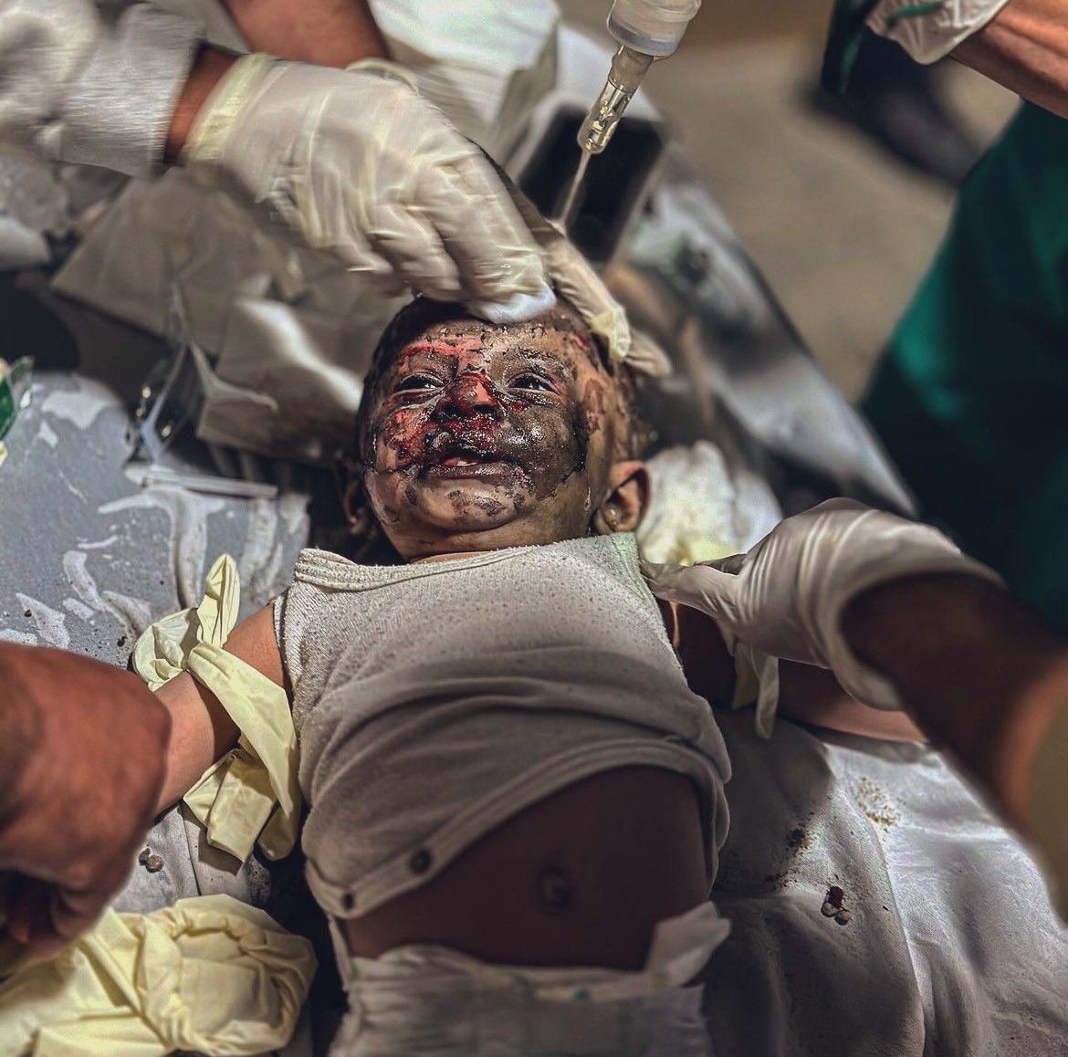Emelia8z0's tweet photo. You did this @POTUS @RishiSunak @netanyahu @EmmanuelMacron @JustinTrudeau @GiorgiaMeloni @AlboMP @StateDeptSpox @vonderleyen @Bundeskanzler

#ChildrenKillers #IsraeliCrime #ZionismIsTerrorism #IsraeliOccupation #genocide #HumanityForAll #EthnicCleansing #forthesakeofGod #ceasefireInGazaNOW  #FreePalestine #ZionistTerror #GazaUnderAttack #GazaGenocide #IDFterrorist #IsraeliApartheid #WarCrimesInGaza #NetanyahuWarCriminal #StopGenocide #Jerusalem #AlAqsa #IsraelTerroristState
#Reconnect_to_gaza