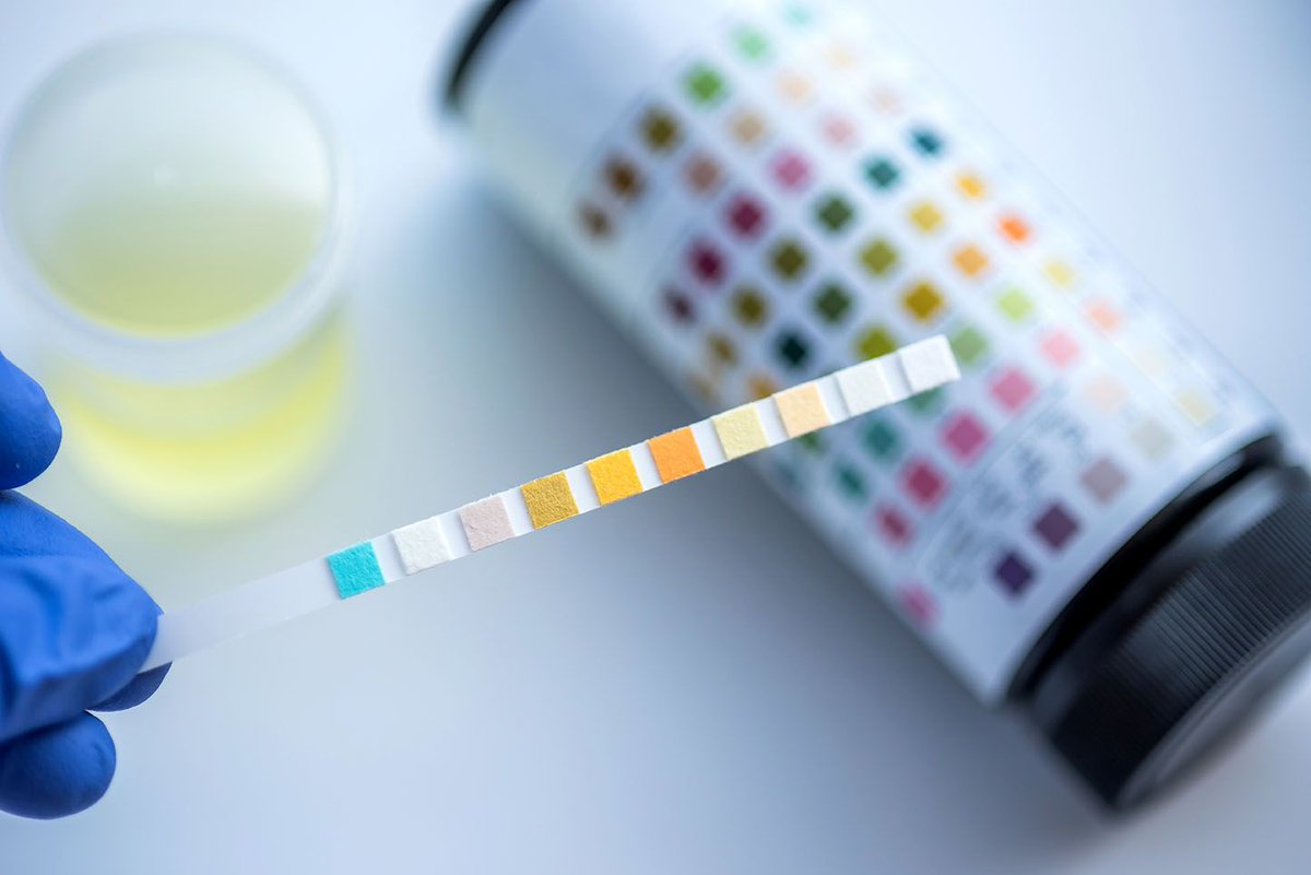 5 Things You Need to Know About Urinalysis in Order to Avoid Unnecessary Antibiotic Treatment
buff.ly/4ae0s5f
#emergencymedicine #intensivecare #respiratory #respiratorycare #icu #nurses #icunurse #ecg #ekg #cme #cmeonline