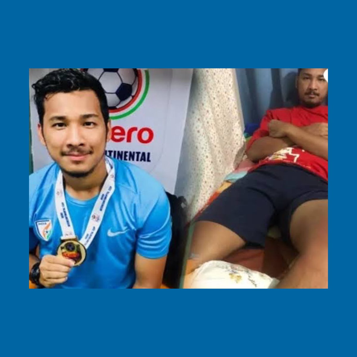 BluePilgrims's tweet photo. Alan Deory, ex @IndianFootball player has been dealt an unlucky hand. He’s struggling to recover from his ACL &amp; PCL surgery &amp; is unable to financially afford the expenses required for recovery. He needs our help. Donate whatever little you can afford. Spread the word https://t.co/njPltaJQlj
