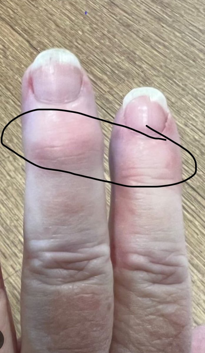 أ.د. سامي بحلس tweet media