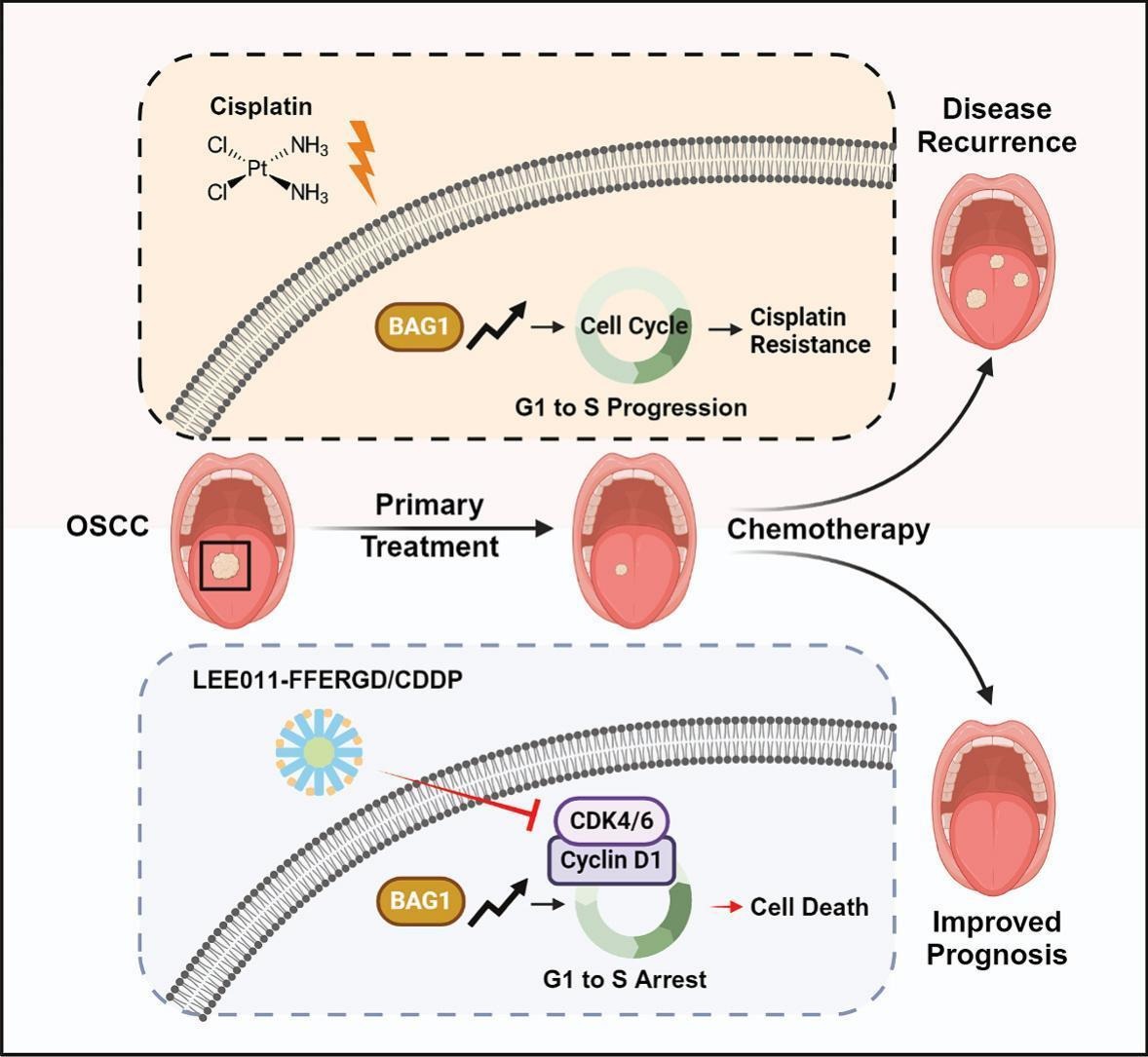 JCRnEDITORS's tweet image. Supramolecular nanodrug targeting CDK4/6 overcomes BAG1 mediated cisplatin resistance in oral squamous cell carcinoma.
| Wei Zhou @PennMedicine |
#supramolecule #nanodrug #cisplatin 
doi.org/10.1016/j.jcon…