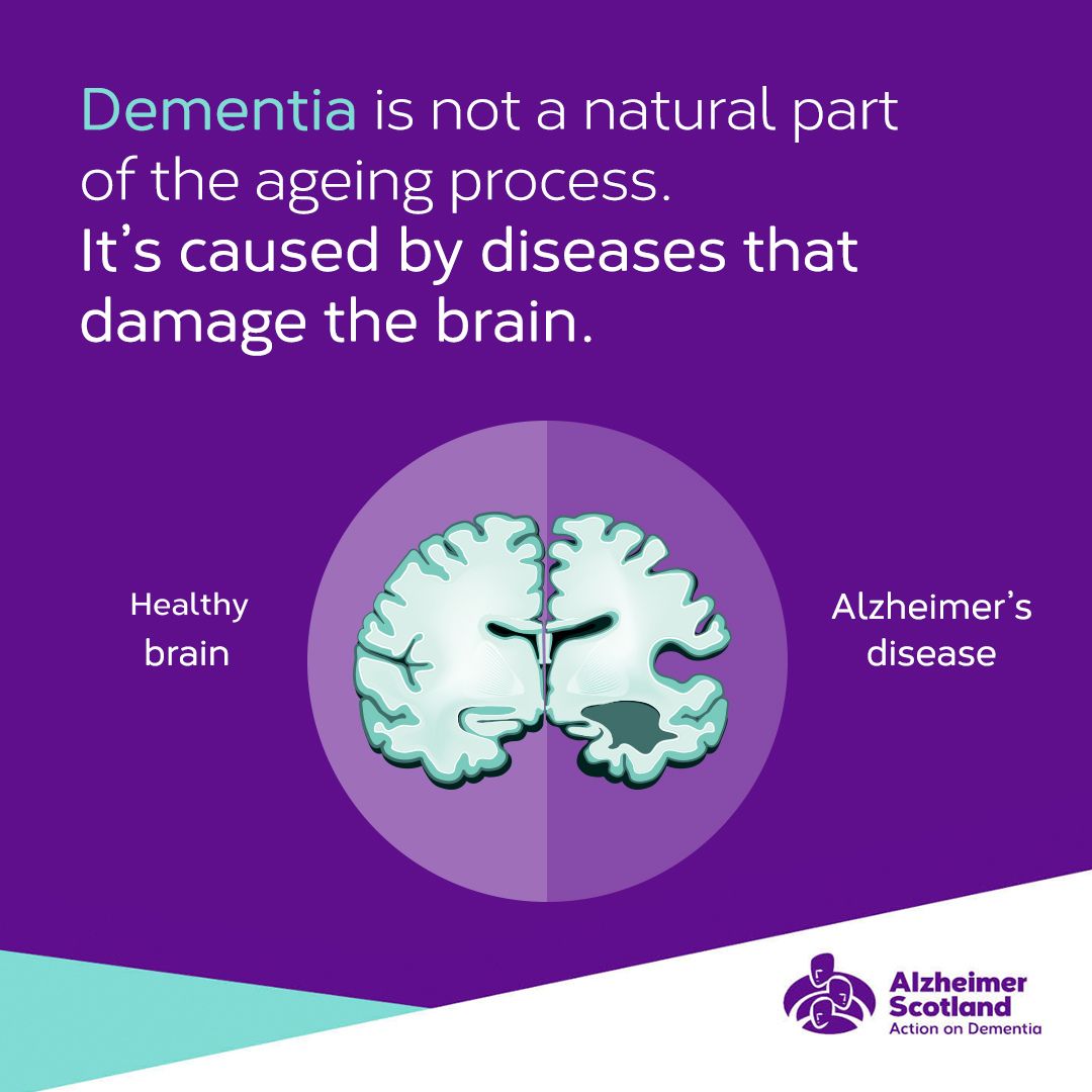 alzscot's tweet image. 🧠 Dementia affects the brain, making it harder to remember things or think as clearly as before. It&apos;s an umbrella term for over 100 different types of illnesses and disease symptoms.

#BrainAwarenessWeek