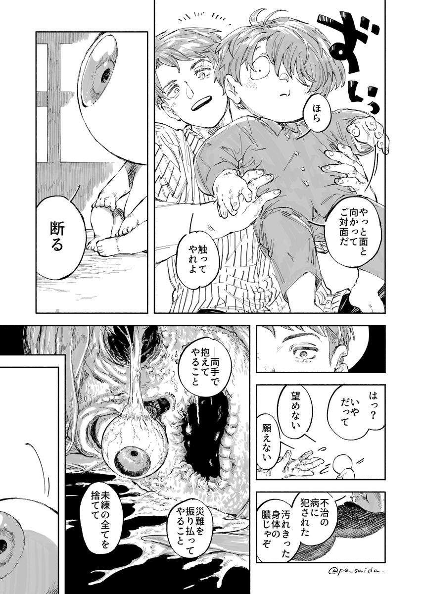 痂(かさぶた)さんこんにちは(2/3) 