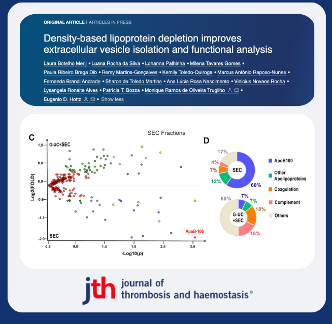 JTHjournal's tweet photo. 🩸plasma is main source of extracellular vesicles #EV in clinical studies ▶️identify biomarkers.

Botelho Merij et al show G-UC+SEC 📉 EV lipoprotein contamination ➖interfering in EV cellular source, gene ontology, and ultrastructure. 
@UFJF_ @IsevOrg 

https://t.co/IYy4UVfFpO https://t.co/L0iqlfGfAL