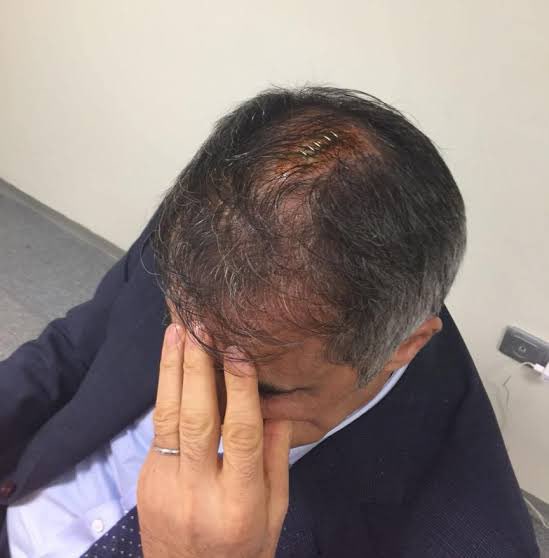 şenol hocanın akrabaları ismail kartalın kafayı yarıp intikam almış