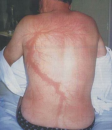 tusmedios's tweet photo. 4. Roy Sullivan

La historia más increíble de mala fortuna es la de Roy Sullivan, alcanzado por rayos… siete veces. El exguardabosques, apodado 'pararrayos humano', está en Guinness World Records por sobrevivir más rayos que nadie en la historia. https://t.co/uhkE1zILkF
