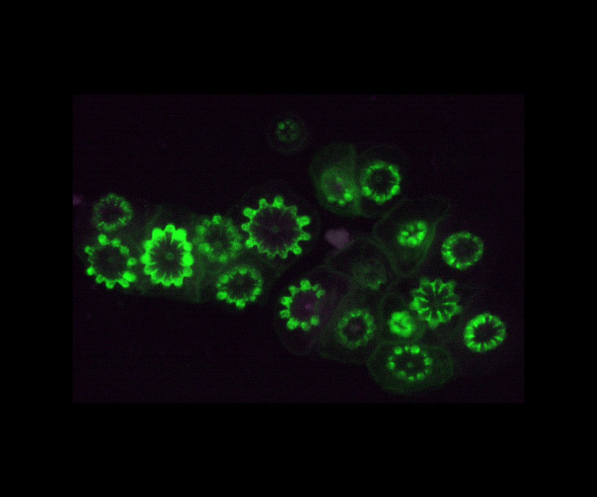 Happy #StPatricksDay!🍀 This green beauty shows the early formation of a small colony of corals from the Hawaiian Montipora capitata coral. 🪸 #Coral polyps have autofluorescence by the expression of the Green Fluorescent Protein. Emma Rangel-Huerta (<a href="/Gibson_Lab/">Gibson Lab</a>)
