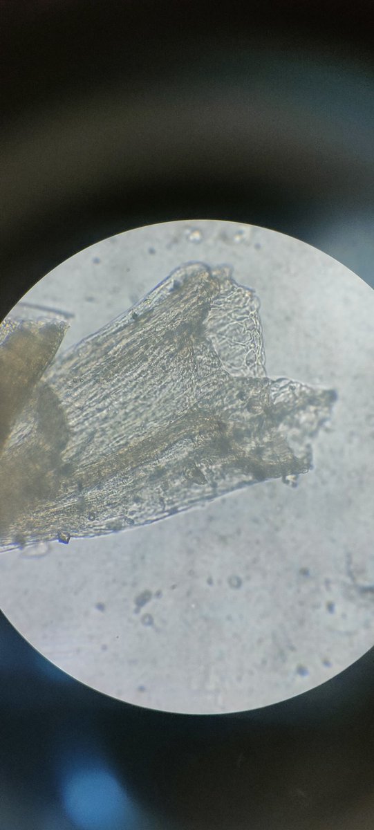 #Lodicule
This structure is responsible for opening of #grass florets. It absorbs moisture and exerts pressure to open the lemma and palea apart revealing the #stamens and #stigma
#Poaceae
#photomicrograph