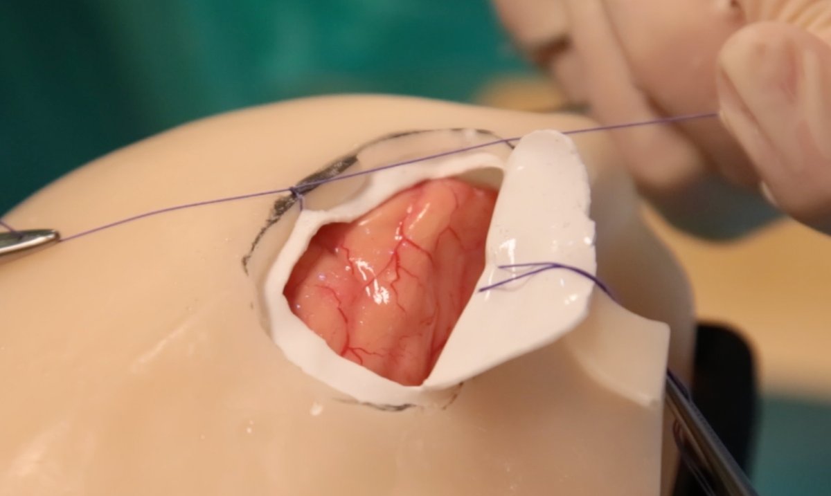 Learn the pterional approach at the cranial practical course at this year's AANS meeting in Chicago. Be sure to sign up when you register for the 2024 AANS meeting.