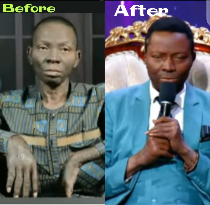 Peeayforever's tweet photo. The power of God is REAL...
What is that sickness? It ENDS NOW if you'll ONLY BELIEVE...
THIS IS YOUR MOMENT!

Participate with this link
https://t.co/SuAajGt2Mn

#hslhs #healingstreams #healingstreamslive #pastorchrislive #cephzone1 #kingschatrecommends #bloodbath #الهلال_ضمك https://t.co/jtCm4k0FUH