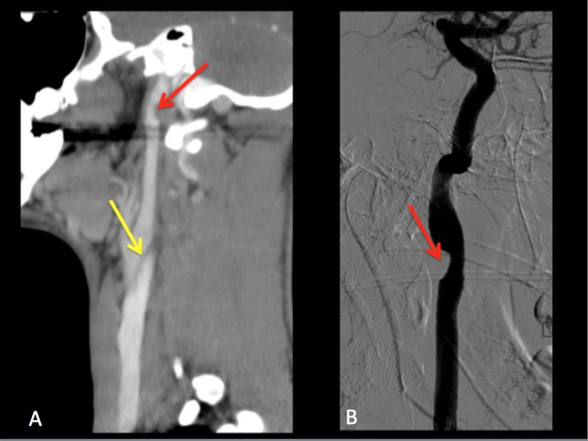 Diagnosis?  (Source: ECR - Amanda  González)