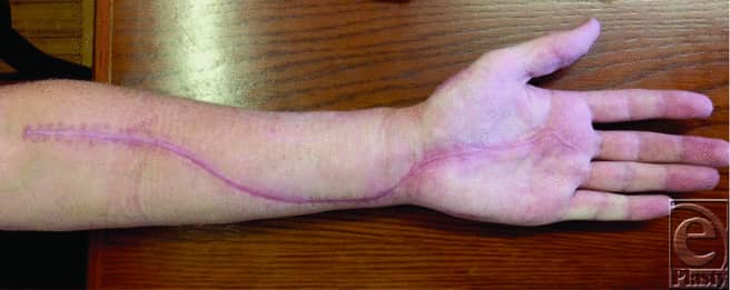 IhabFathiSulima's tweet photo. What is the diagnosis? https://t.co/QfLH2SlqmC