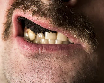 $SNUS on Solana just launched on pump.fun 

Shove a SNUS up your lip and degen some fkn solami shitters

pump.fun/4KNZMT2uvZ2Hpz…