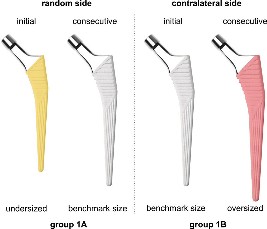 Tobias Konow & coauthors found that stem size and stem alignment affects periprosthetic fracture risk and primary stability in cementless total hip arthroplasty: onlinelibrary.wiley.com/doi/10.1002/jo…