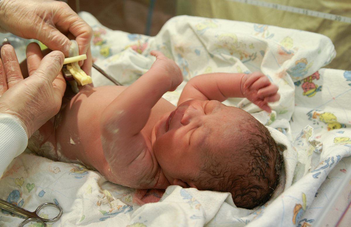 Studies show waiting even a minute before clamping a baby's umbilical cord has benefits. 'It’s standard practice for midwives and ob-gyns to perform delayed cord clamping at birth,' Dartmouth Hitchcock Clinics Bedford's Maris Toland, MD, told @thebump. bit.ly/4a7Vc3d
