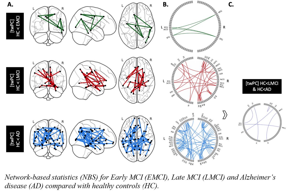 Track-weighted PET connectome: a method to combine PET and MRI fibre-tracking to define a patient-specific PET connectome (dx.doi.org/10.1002/hbm.26…). We applied it to ADNI dementia data. Work from PhD thesis of Zhuopin (Pin) Sun, +collaboration with @StevenRMeikle & @Prof_Naismith