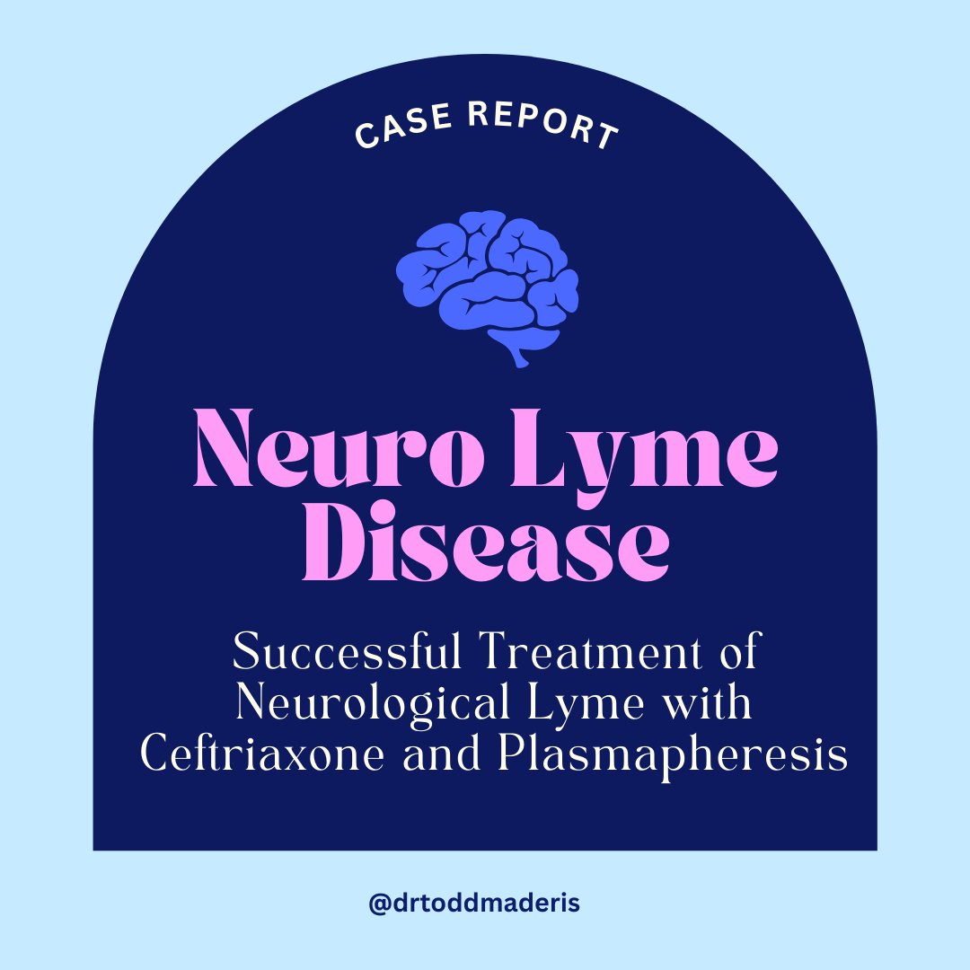 [CASE REPORT] Successful Treatment of Neurological Lyme with Ceftriaxone and Plasmapheresis A 4-year-old boy presented to the emergency department with abdominal pain and symmetrical ascending progression of muscle weakness causing respiratory failure. He was diagnosed with…