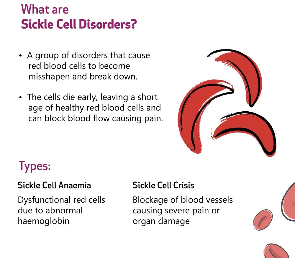 What Causes Red Blood Cells To Sickle