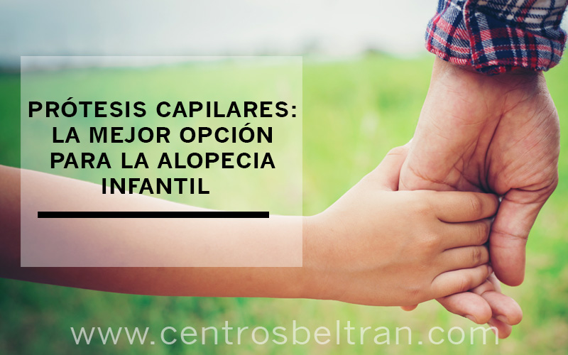 CentrosBeltran's tweet photo. Generalmente la alopecia aparece tanto en hombres y mujeres en la edad adulta pero también hay niños con problemas capilares desde pequeños.

Para ellos en Centros Beltrán siempre recomendamos las prótesis capilares a medida por diferentes razones.

https://t.co/9A61NfFgrC https://t.co/9d7dXUkSmD