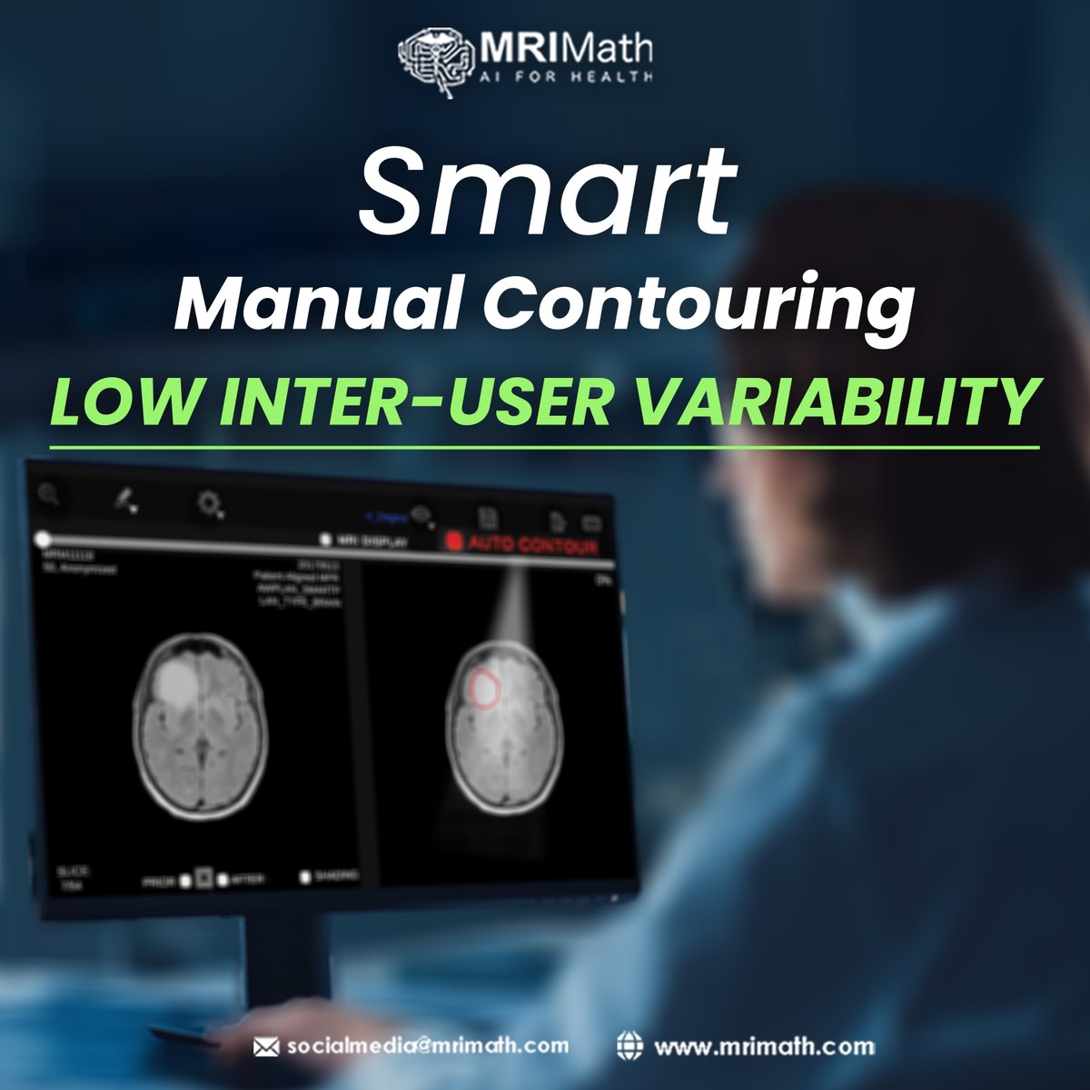 MRIMath offers smart manual contouring of any tumor on CT or MRI that yields low inter-user variability!

Feel free to contact us to learn more using our email: info@mrimath.com.