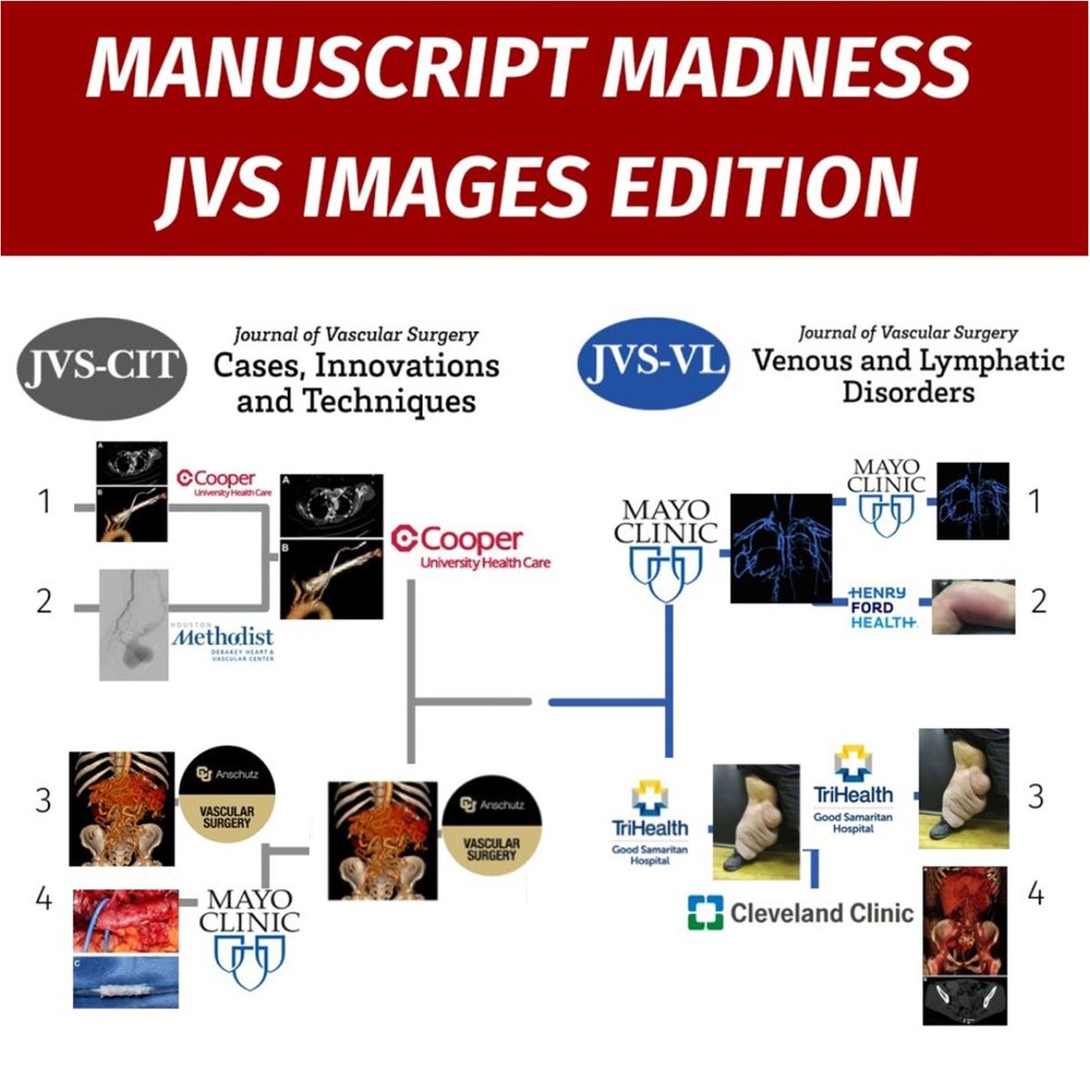 ROUND 3 of #ManuscriptMadness is ON! Review the articles below &amp; vote on Wednesday! 

<a href="/patrickmuckmd/">@PatrickMuckMD</a> <a href="/TriHealthVasc/">TriHealth Vascular Surgery</a> <a href="/NCP_MD/">Nolan C. Cirillo-Penn</a> <a href="/MayoVascSurgery/">Mayo Clinic Vascular and Endovascular Surgery</a> <a href="/JVascSurgCIT/">JVS-Cases Innovations and Techniques</a> <a href="/VascularSVS/">Vascular SVS</a> 

jvsvenous.org/article/S2213-…

jvsvenous.org/article/S2213-…