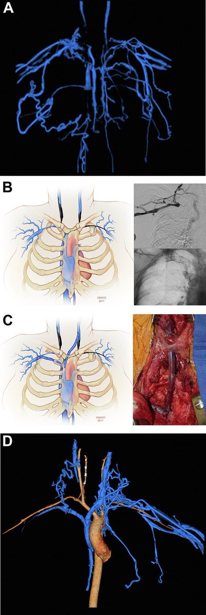 JVS - Venous and Lymphatic Disorders tweet media