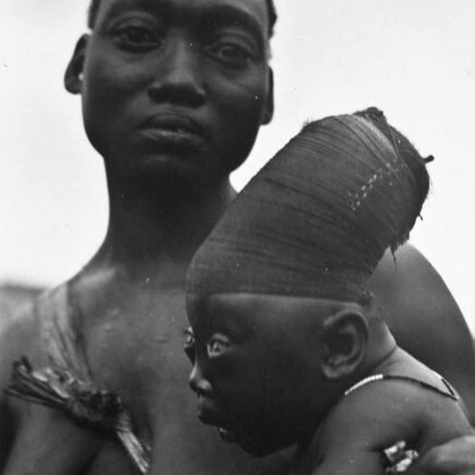 The Mangbetu tribe in Congo still sometimes elongate their children's heads.

And while most of these traditions have been shunned, we still cut babies' dicks.

Any permanent bodily deformation shouldn't be forced on children.

Don't cut babies'  dicks.