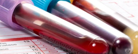 Un análisis de sangre detecta de forma precoz el cáncer de colon

omniprex.com/un-analisis-de…