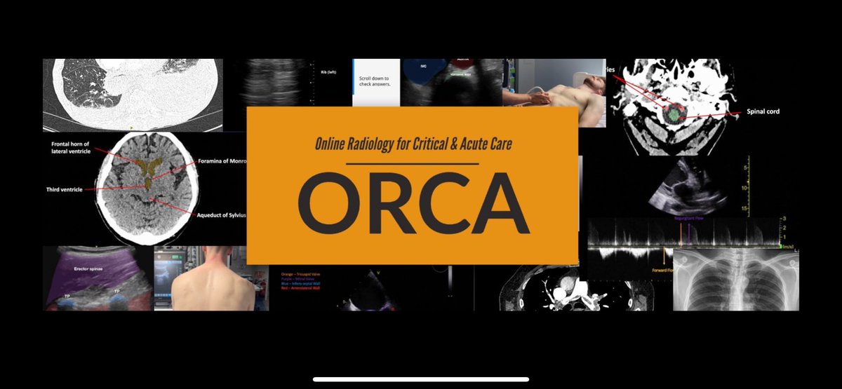 Very excited to announce the ORCA (Online Radiology for Critical and Acute care). A free online interactive resource for acute radiology education. Please follow @ORCA_education for more information and access! A hugely talented and dedicated team working on this continually!