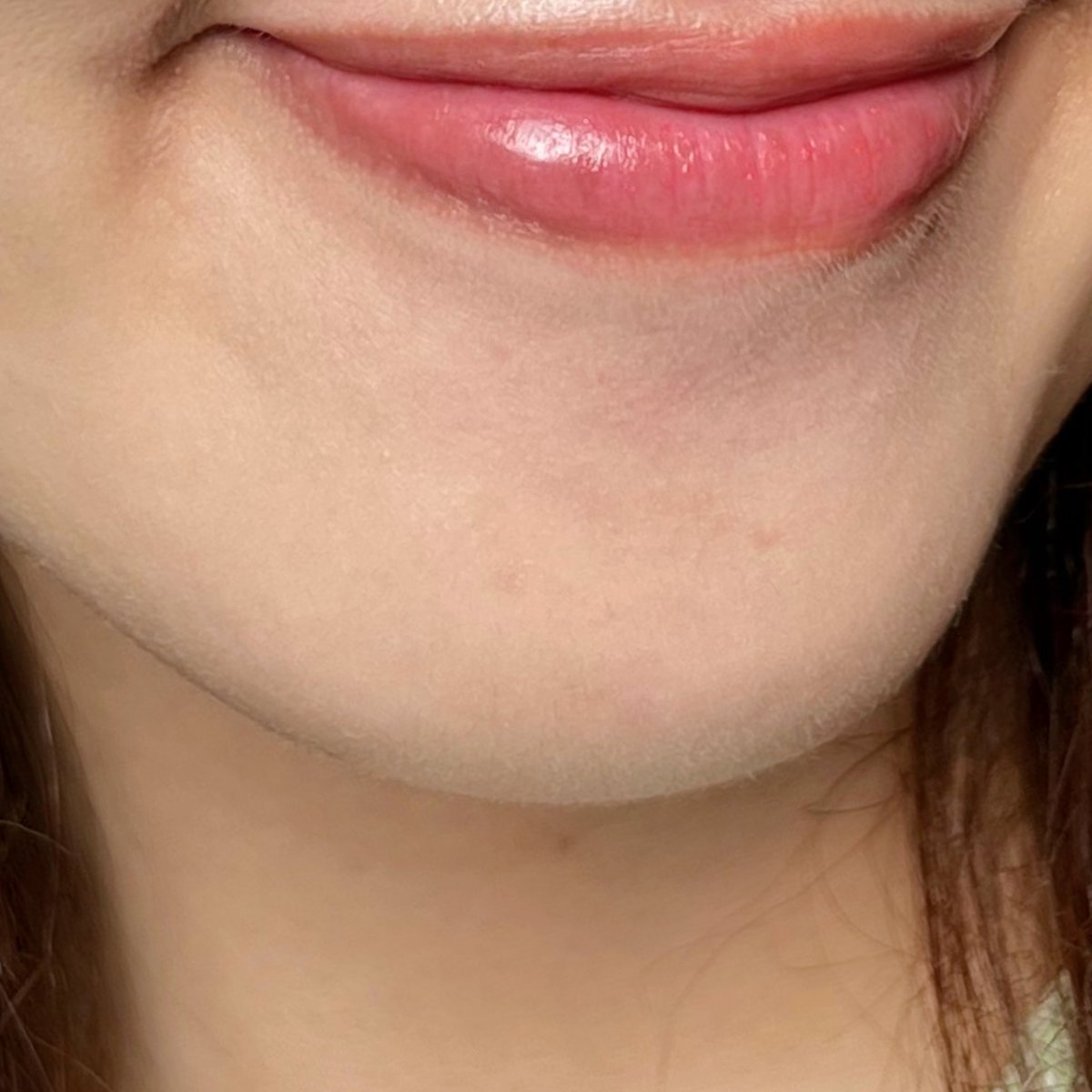 moonmoonreview's tweet photo. สิวขึ้นคางบ่อยมากกก แต่ใช้ La Roche-Posay Effaclar Duo+M สูตรใหม่ แล้วสิวแห้งไวขึ้นแบบปรู้ดปร้าด รอยดำจางลงไปเยอะ ชอบที่มีไมโครไบโอม สิวไม่ค่อยขึ้นซ้ำด้วย ทาไปเลย เช้า-เย็น เพราะอ่อนโยน ไม่ทำให้อุดตัน ใครเป็นสิวคือใช้ด่วน น้องดีจริง

#LaRochePosayTH #Effaclar #เอฟฟาคลาร์ #เอฟฟาคลาร์ดูโอพลัสเอ็ม